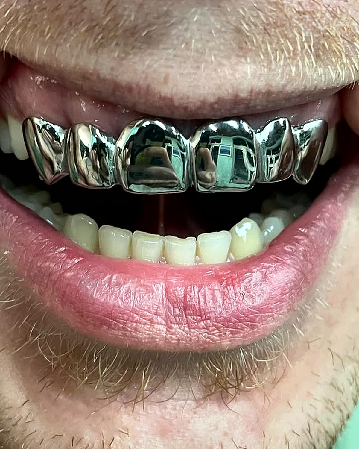 Custom grillz: Six-tooth bottom · silver
