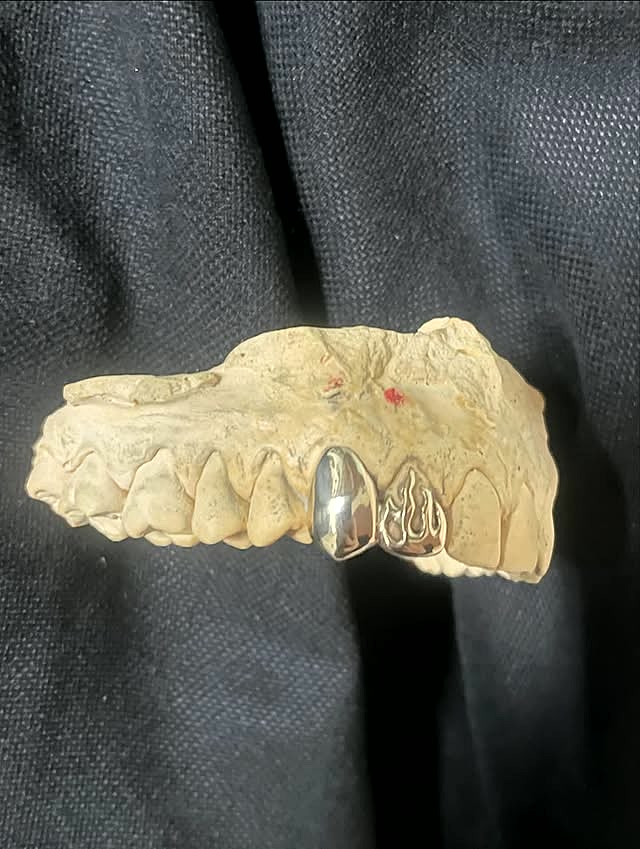 Custom silver flame-cut grillz caps set on a dental cast