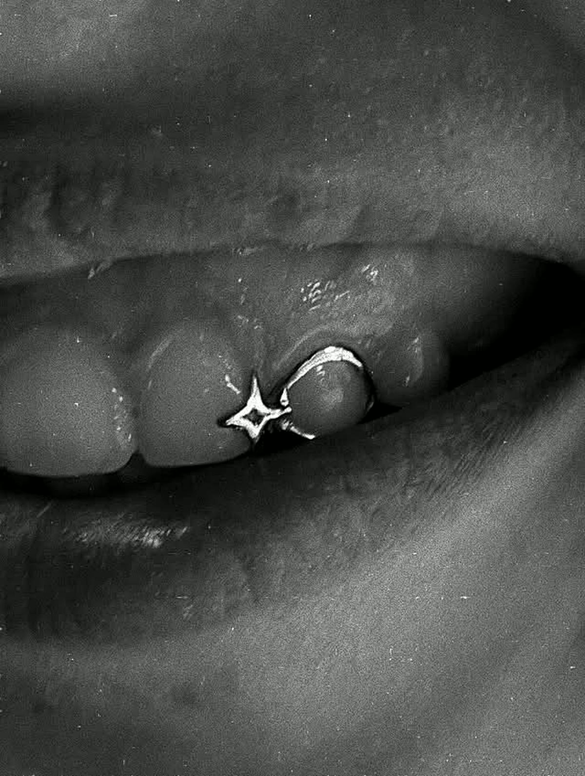 Black and white macro of a custom star-shaped silver tooth piece